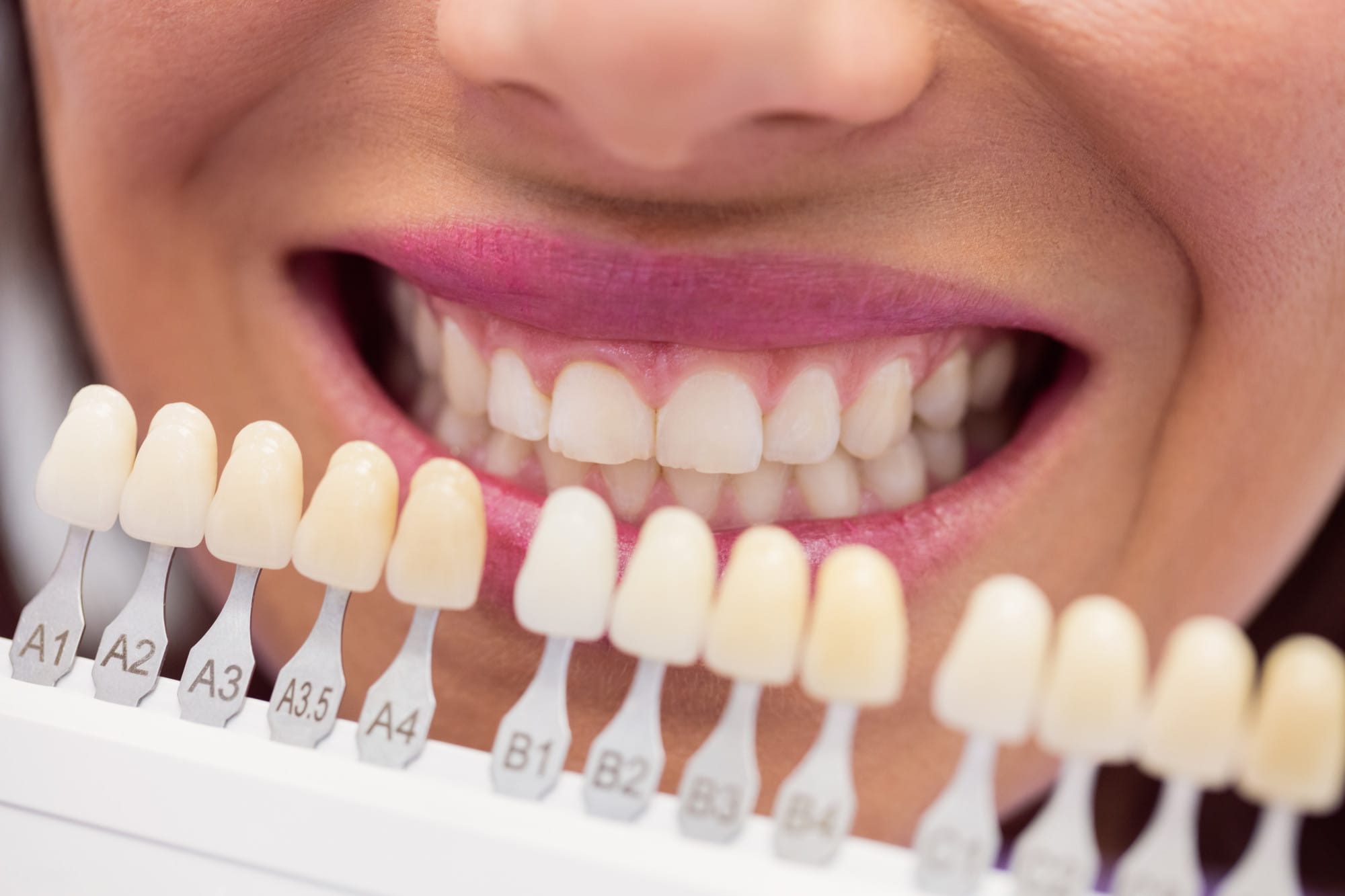 Smiling woman with bright white teeth after professional teeth whitening in Canberra